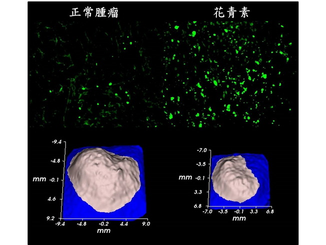 肺大細胞癌使用花青素(Cyanidin 3-O-glucoside)後腫瘤細胞死亡數增加(綠色螢光增加，右上圖)且腫瘤3D立體圖顯示肺癌腫瘤的體積明顯變小(右下圖)。(照片由研究者提供)