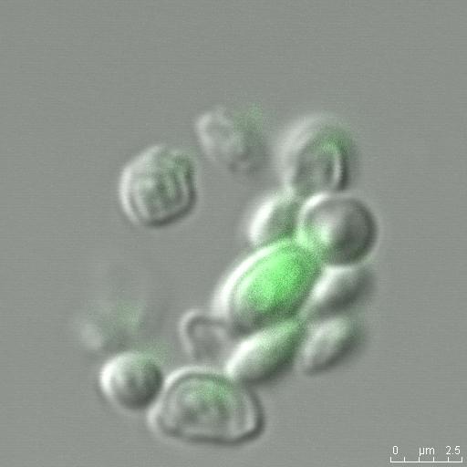 雷射共軛焦顯微鏡分析酵母菌轉基因表現